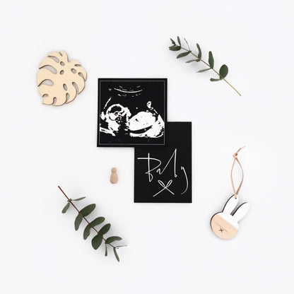 An unframed 5 inch square foil baby scan print, with the scan recreated in silver foil, on to black cardstock. The baby scan is photographed next to props, including a small print which reads "baby", 2 stems of eucalyptus and some wooden decorations.
